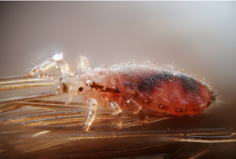 Crippling, Crawling Paranoia: Things You Didn’t Know About A Lice Infestation